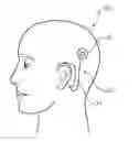 Fig. 01 - Headworn sound processor case