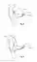 Fig. 05 - Hearing aid