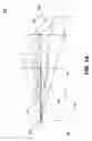 Fig. 02 - Optimized implementation of back projection for computed tomography (CT)