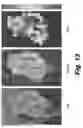 Fig. 14 - Method, system, software and medium for advanced intelligent image analysis and display of medical images and information