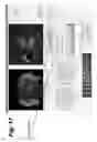 Fig. 17 - Method, system, software and medium for advanced intelligent image analysis and display of medical images and information