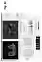 Fig. 44 - Method, system, software and medium for advanced intelligent image analysis and display of medical images and information