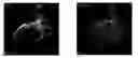 Fig. 01 - Method and system for 3D cardiac motion estimation from single scan of C-arm angiography