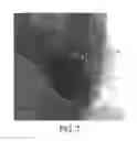 Fig. 07 - Method and system for 3D cardiac motion estimation from single scan of C-arm angiography