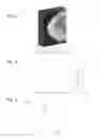 Fig. 04 - Imaging method and apparatus with optimized grayscale value window determination