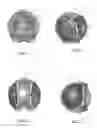 Fig. 02 - Universal underwater enclosure for cameras and camcorders