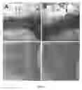 Fig. 05 - Compositions and Methods for Detecting and Treating Implant Loosening and Osteolysis
