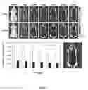 Fig. 06 - Compositions and Methods for Detecting and Treating Implant Loosening and Osteolysis