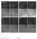 Fig. 07 - Compositions and Methods for Detecting and Treating Implant Loosening and Osteolysis