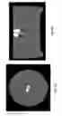 Fig. 22 - MRI markers, delivery and extraction systems, and methods of manufacture and use thereof
