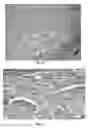 Fig. 06 - Human Placental Derived Extracellular Matrix and Uses Therof