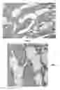 Fig. 08 - Human Placental Derived Extracellular Matrix and Uses Therof