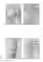 Fig. 06 - Compositions and Methods for Implantation of Processed Adipose Tissue and Processed Adipose Tissue Products