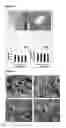 Fig. 08 - Compositions and Methods for Implantation of Processed Adipose Tissue and Processed Adipose Tissue Products