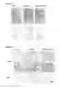 Fig. 10 - Compositions and Methods for Implantation of Processed Adipose Tissue and Processed Adipose Tissue Products