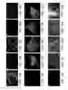 Fig. 14 - INDUCED PLURIPOTENT STEM CELLS AND METHODS OF USE