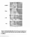 Fig. 04 - COMPOSITIONS AND METHODS FOR TREATING NEURODEGENERATIVE DISEASES