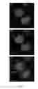 Fig. 14 - Assisted enzyme replacement therapy