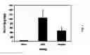 Fig. 03 - PURIFICATION AND ISOLATION OF RECOMBINANT OXALATE DEGRADING ENZYMES AND SPRAY-DRIED PARTICLES CONTAINING OXALATE DEGRADING ENZYMES