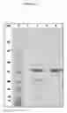 Fig. 13 - Manufacture of active highly phosphorylated human N-acetylgalactosamine-6-sulfatase and uses thereof