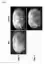 Fig. 13 - STIM2-MEDIATED CAPACITIVE CALCIUM ENTRY