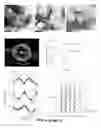 Fig. 10 - CROSS-ß STRUCTURE COMPRISING AMYLOID-BINDING PROTEINS AND METHODS FOR DETECTION OF THE CROSS-ß STRUCTURE, FOR MODULATING CROSS-ß STRUCTURES FIBER FORMATION AND FOR MODULATING CROSS-ß STRUCTURE-MEDIATED TOXICITY