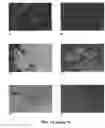 Fig. 12 - CROSS-ß STRUCTURE COMPRISING AMYLOID-BINDING PROTEINS AND METHODS FOR DETECTION OF THE CROSS-ß STRUCTURE, FOR MODULATING CROSS-ß STRUCTURES FIBER FORMATION AND FOR MODULATING CROSS-ß STRUCTURE-MEDIATED TOXICITY
