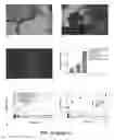 Fig. 13 - CROSS-ß STRUCTURE COMPRISING AMYLOID-BINDING PROTEINS AND METHODS FOR DETECTION OF THE CROSS-ß STRUCTURE, FOR MODULATING CROSS-ß STRUCTURES FIBER FORMATION AND FOR MODULATING CROSS-ß STRUCTURE-MEDIATED TOXICITY