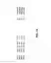 Fig. 15 - Detection of amyloid deposits using anti-amyloid antibodies