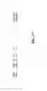 Fig. 18 - Detection of amyloid deposits using anti-amyloid antibodies