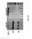 Fig. 33 - Detection of amyloid deposits using anti-amyloid antibodies