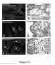 Fig. 30 - TREATMENT OF COMPLEMENT-ASSOCIATED DISORDERS