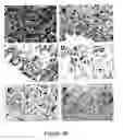 Fig. 33 - TREATMENT OF COMPLEMENT-ASSOCIATED DISORDERS
