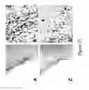 Fig. 34 - TREATMENT OF COMPLEMENT-ASSOCIATED DISORDERS