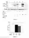 Fig. 04 - Pharmaceutical composition for treating ischemic events