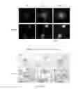 Fig. 28 - METHOD OF TREATING NEURODEGENERATIVE DISEASE