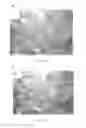 Fig. 31 - METHOD OF TREATING NEURODEGENERATIVE DISEASE
