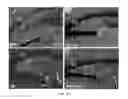 Fig. 41 - METHOD OF TREATING NEURODEGENERATIVE DISEASE