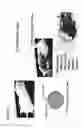 Fig. 27 - Compositions and methods to treat and control tumors
