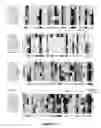 Fig. 03 - Chimeric influenza virus-like particles comprising hemagglutinin
