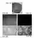 Fig. 06 - Cancer stem cell antigen vaccines and methods