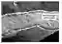 Fig. 01 - Hydrogel bioscaffold and coating for bone and tooth repair