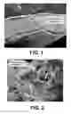 Fig. 02 - Hydrogel bioscaffold and coating for bone and tooth repair