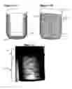 Fig. 12 - Solid forms for tissue repair