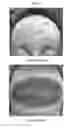Fig. 12 - FORMULATIONS