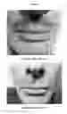 Fig. 14 - FORMULATIONS