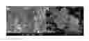 Fig. 01 - Composite of amorphous calcium phosphate/calcium sulfate hemihydrate (CSH/ACP) for bone implantation and process for producing the same