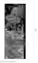 Fig. 02 - Composite of amorphous calcium phosphate/calcium sulfate hemihydrate (CSH/ACP) for bone implantation and process for producing the same