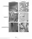 Fig. 08 - Composite of amorphous calcium phosphate/calcium sulfate hemihydrate (CSH/ACP) for bone implantation and process for producing the same