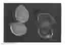 Fig. 01 - Polysaccharide gel formulation having multi-stage bioactive agent delivery